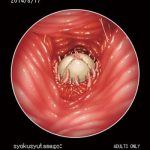 syokusyu tamago cover